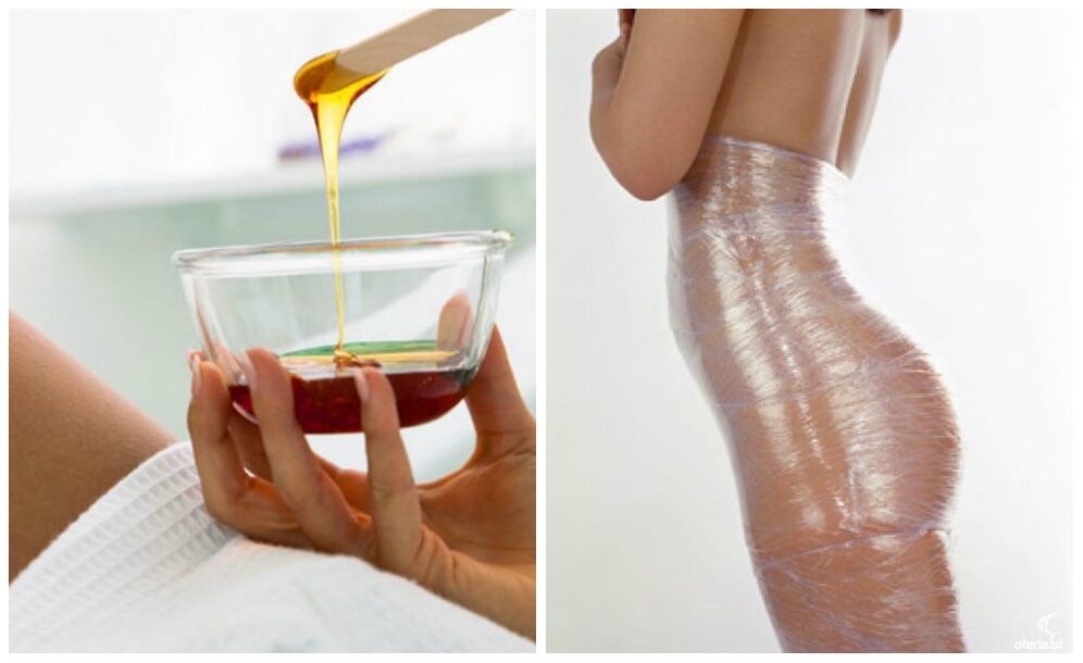 kilo kaybı için vücut sargıları